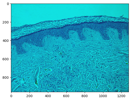_images/a5ae09d4b884bdf23433a22d36c912032fa868016f32103f9a826498246d1727.png